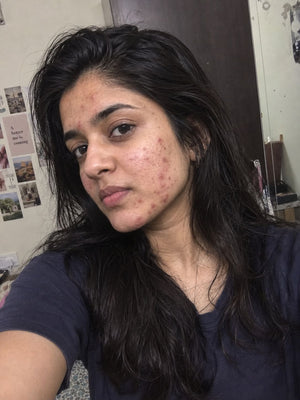 Recurring Breakouts