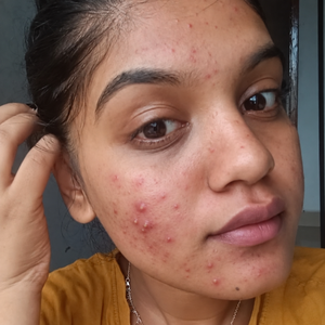 Recurring Breakouts